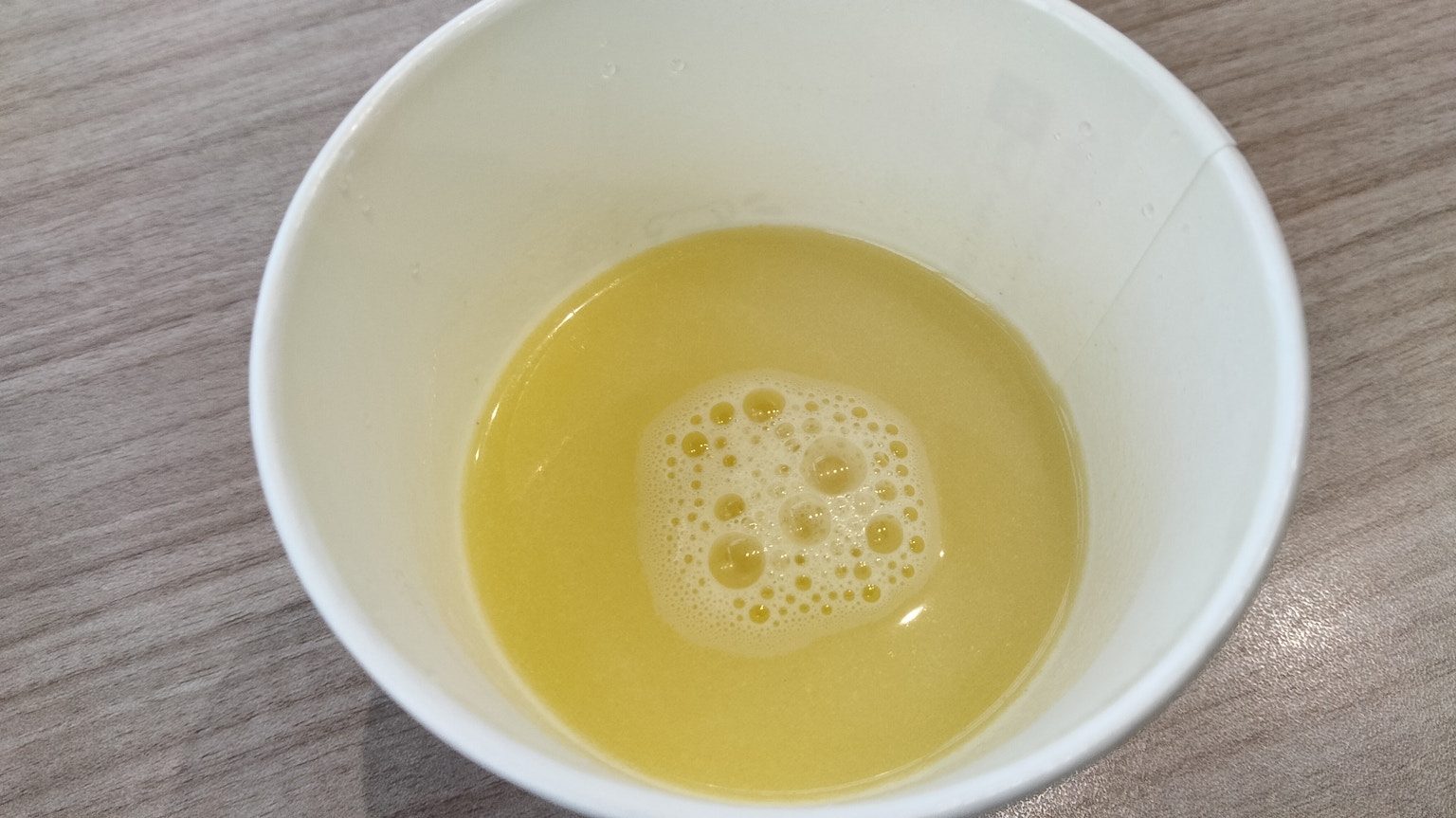 ของเหลวสีเหลืองที่มีฟองในถ้วยสีขาว
