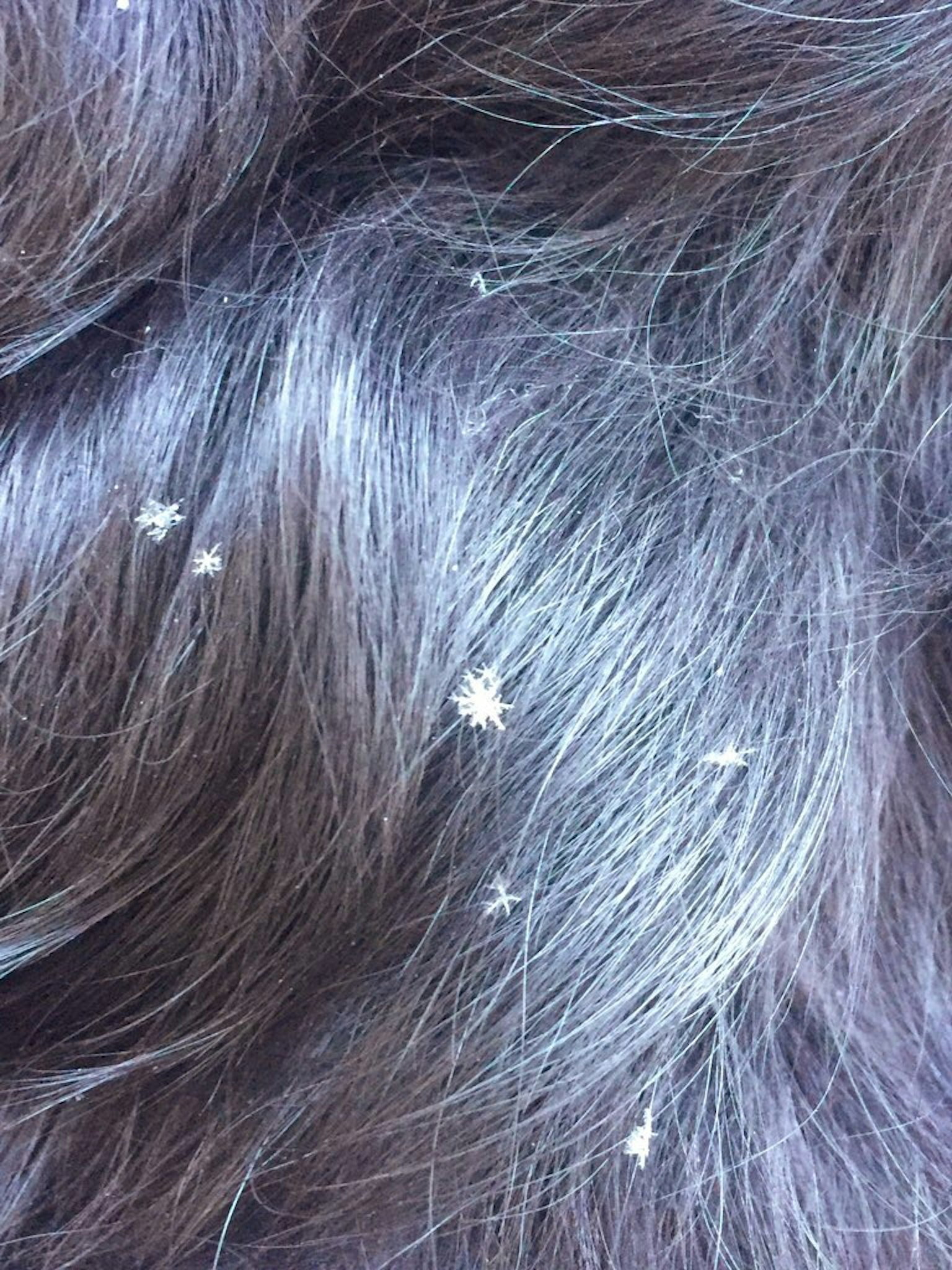 深色頭髮上散落著白色雪花