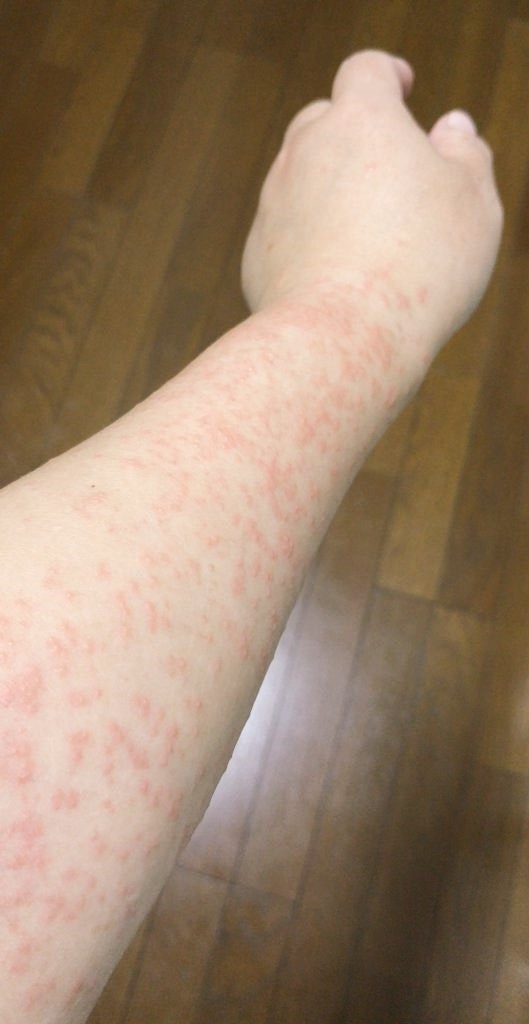 床の上で腕を伸ばす人の手首と前腕
