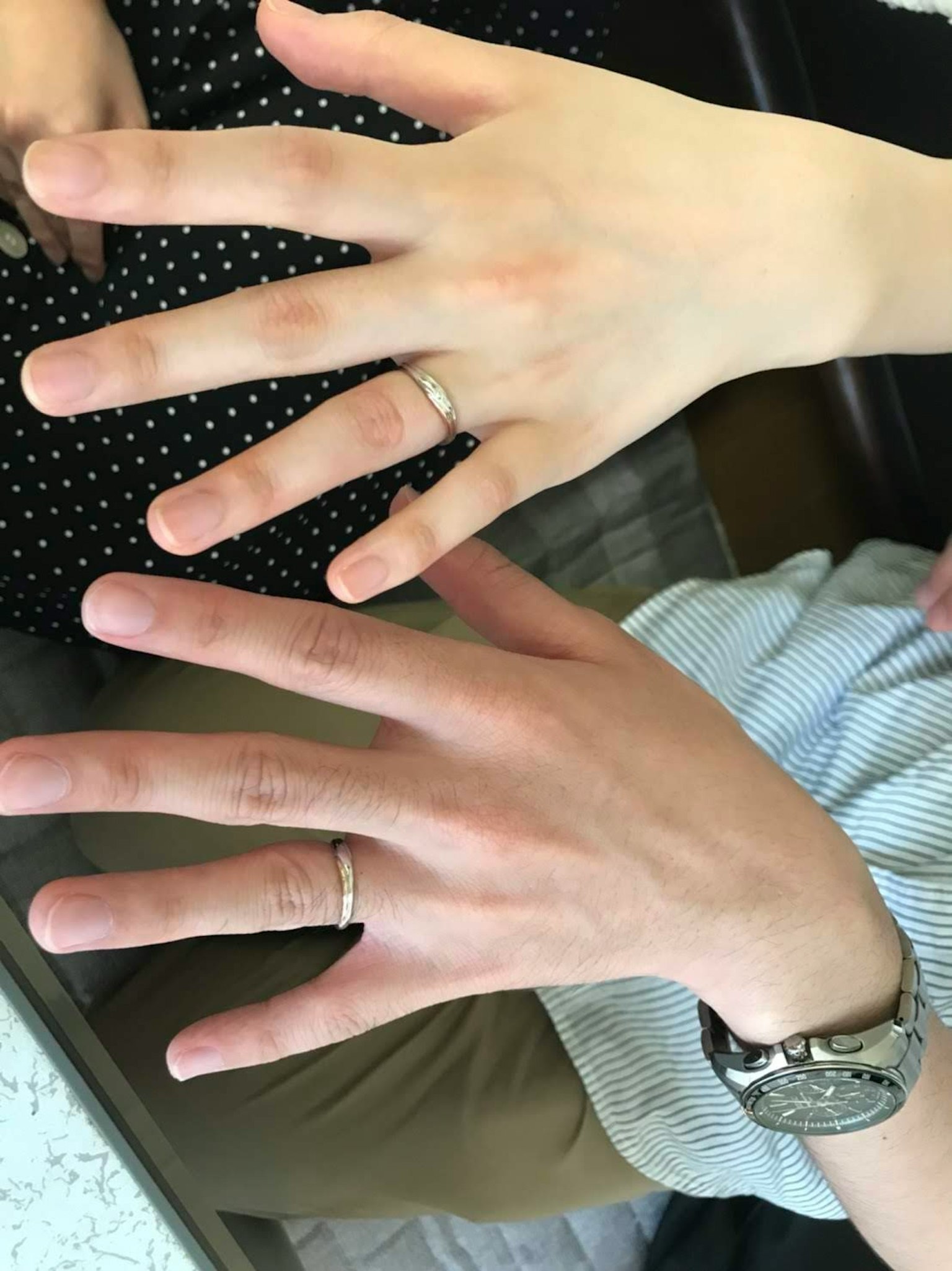 Two hands overlapping with visible wedding rings