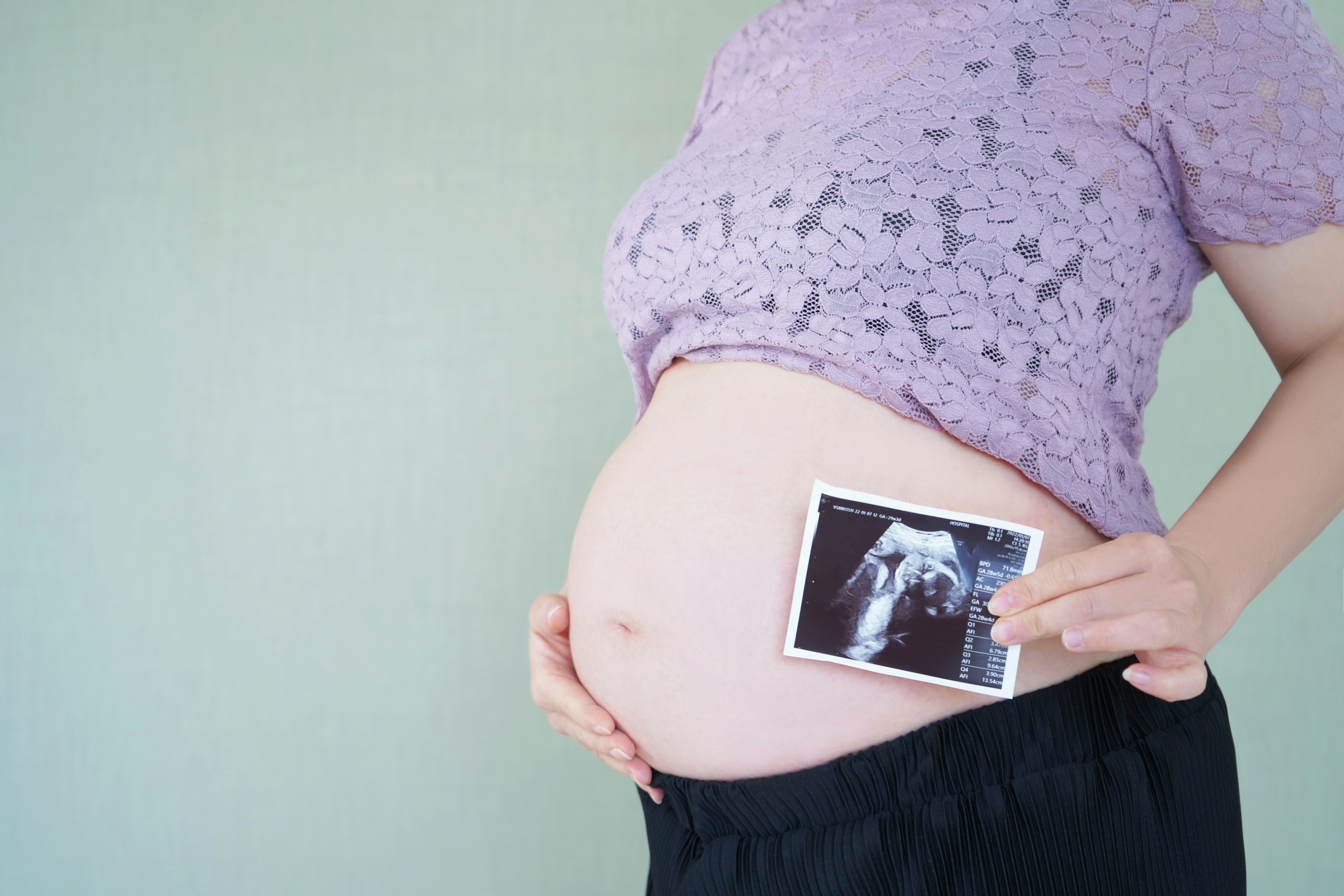 妊娠中の女性のお腹にエコー写真を当てる手元