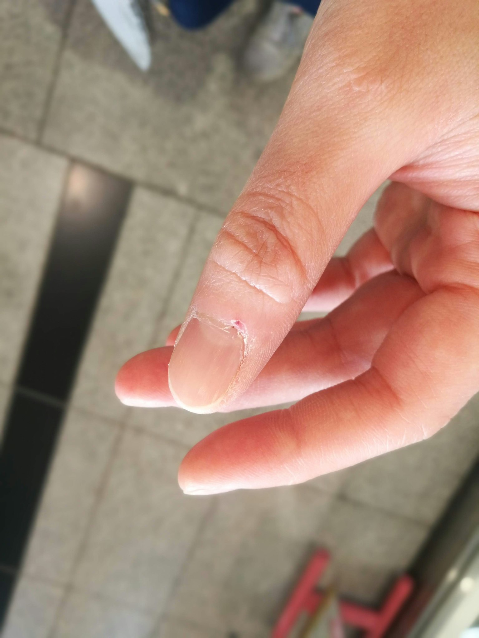 Image of a hand showing a cut on the finger