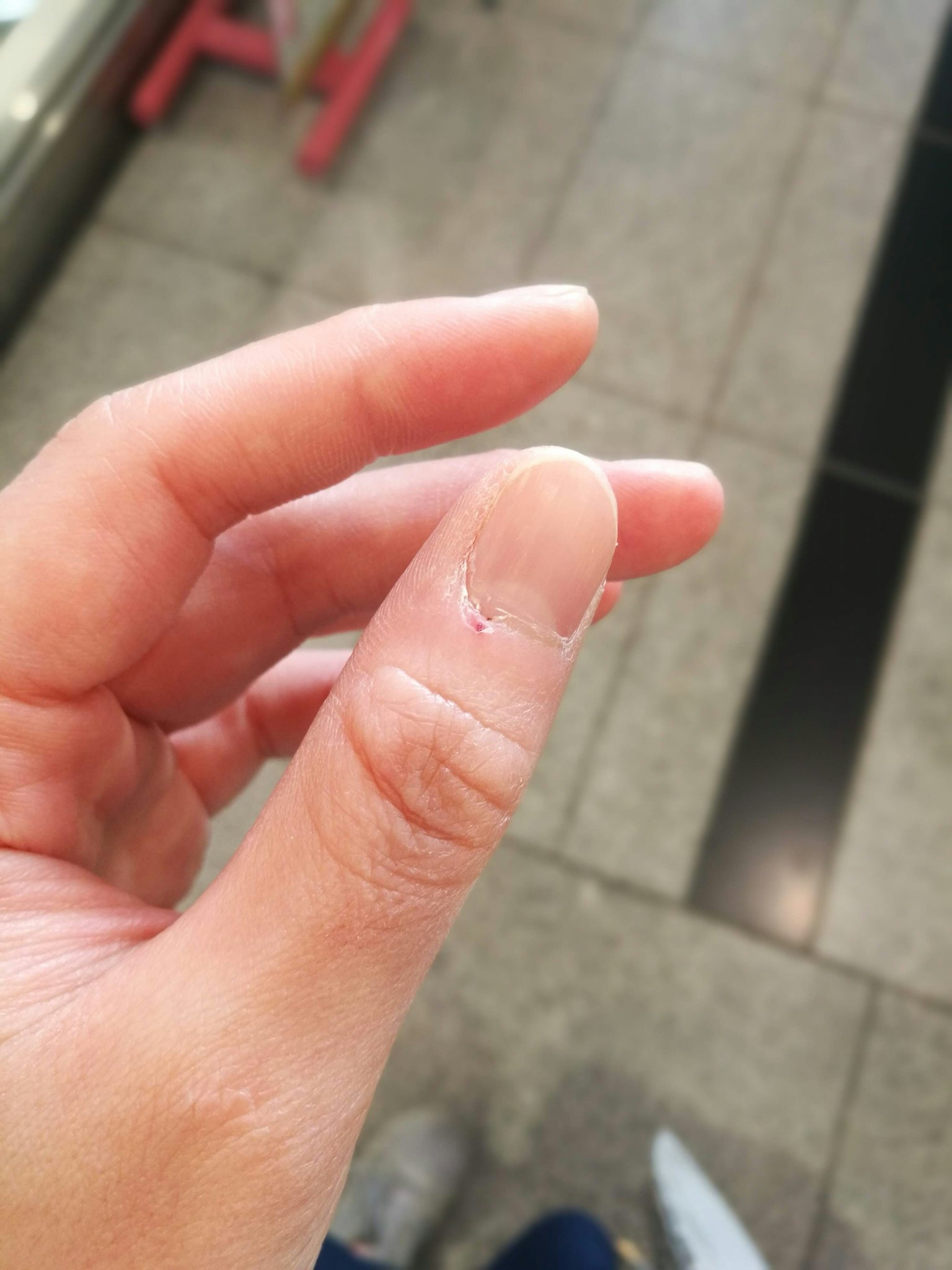 手的特写，手指尖有小伤口，背景是瓷砖地面