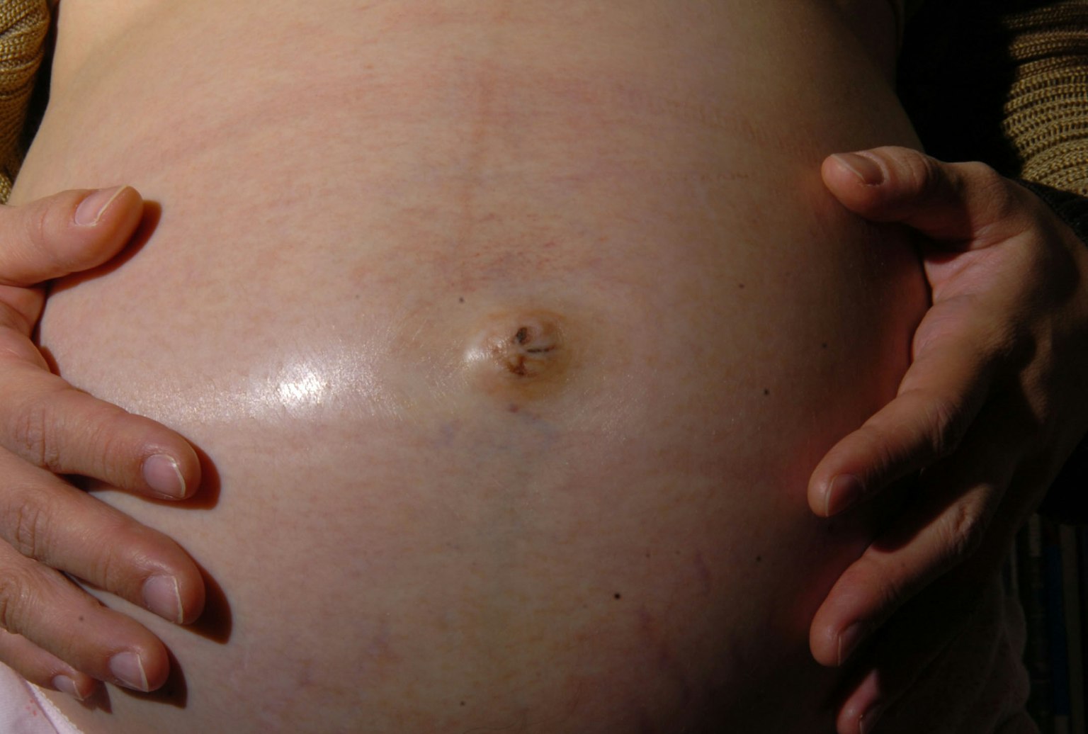 Pregnant woman's abdomen with hands